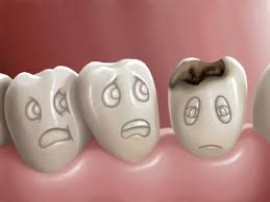 Triệu chứng và cách chữa trị bệnh lý răng miệng.