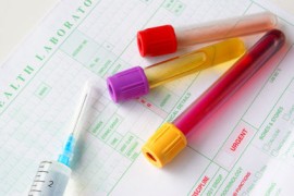 ​Khi nào nên đi xét nghiệm STD?