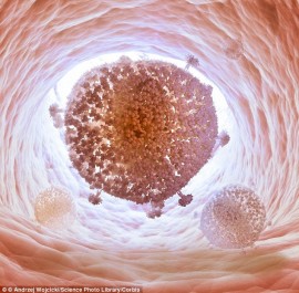 Lần đầu tiên “xóa sổ” vi rút HIV khỏi tế bào của người