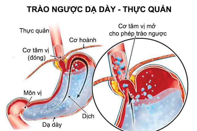 trao nguoc da day