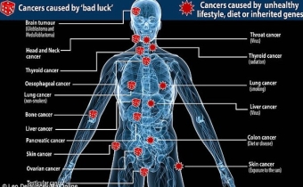 Nguyên nhân dẫn đến bệnh ung thư mà bạn không ngờ tới